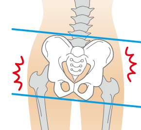 重要ポイント④　骨盤